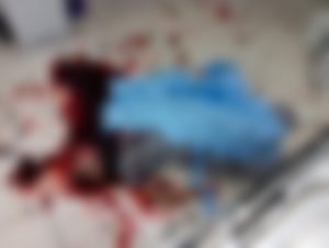 Imagem chocante mostra funcionário de hospital que foi decapitado; crime foi motivado por ciúmes