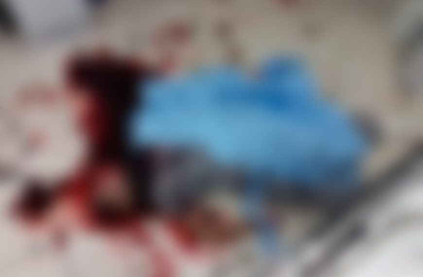 Imagem chocante mostra funcionário de hospital que foi decapitado; crime foi motivado por ciúmes