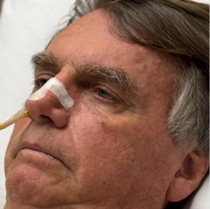 Médicos indicam cirurgia para Bolsonaro após exames; duas hérnias inguinais