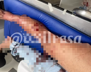 Homem é esfaqueado por ‘desconhecida’, mas se recusa a denunciar agressora em Rondonópolis; veja