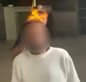 Vídeo impressionante mostra adolescente ateando fogo na cabeça de homem bêbado e rindo