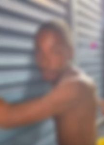 Homem com deficiência é forçado a tomar tadala e passa 15 dias com ereção até ser operado: “perdeu parte do corpo”; vídeo