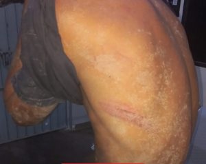 Facção tortura dois homens com afogamento e água contaminada por suposto furto de celular em MT