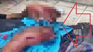 Homem sofre salve de facção e imagens da tortura são assustadoras