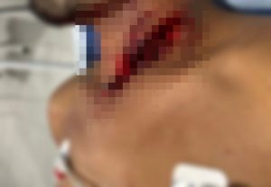 Esposa corta o pescoço do marido com navalha após ele negar sexo em MT; imagem forte
