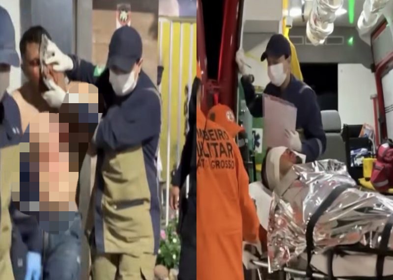 BANHO DE SANGUE: Morador sai pra ver barulho e acaba baleado no olho por faccionado em MT; vídeo forte