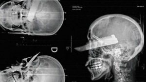 ‘Cheirado de pó’, homem crava faca no olho da esposa e a deixa cega após crise de ciúmes; PM prendeu o suspeito