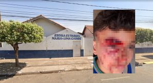 Criança é espancada dentro de Escola Estadual em Rondonópolis; veja