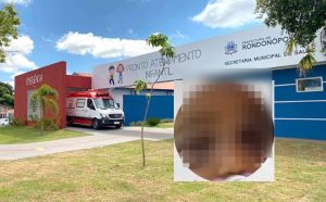 Suspeita de agressão: criança surge com hematomas e caso envolve família do menino Samuel em Rondonópolis