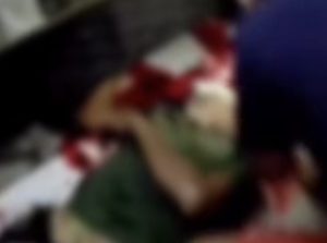 Homem é esfaqueado no pescoço por amigo e acaba em estado gravíssimo no Hospital Regional; vídeo forte