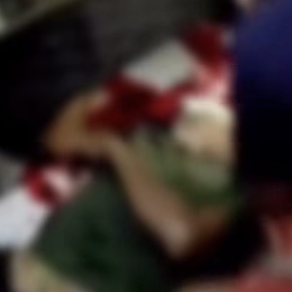 Homem é esfaqueado no pescoço por amigo e acaba em estado gravíssimo no Hospital Regional; vídeo forte