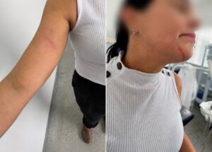 Paciente surtada briga com médica grávida, agride auxiliar e faz ameaça de morte em Rondonópolis