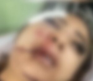 Garota de programa fica desacordada após ser brutalmente espancada por cliente em MT; vídeo forte