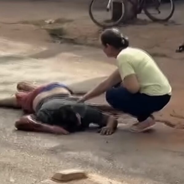 Motociclista colide com caminhonete e acaba com fraturas expostas no Hospital Municipal; vídeo
