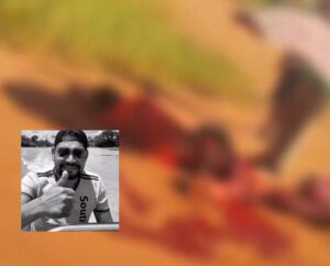 Homem morre no Hospital Regional após sofrer grave acidente e ter perna amputada; vídeo forte