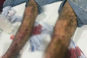 Homem é baleado e quase é ‘levado de arrasto’ na região de Rondonópolis; primo acredita que era o alvo