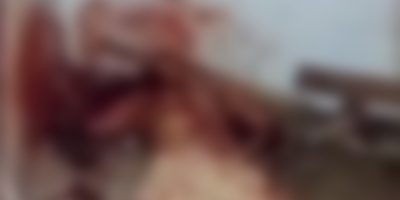 imagem_borrada_moderada