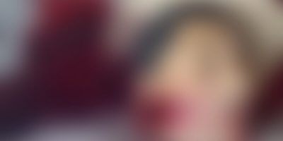 photo-output